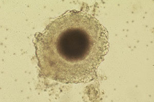 Bovine oocyte Surrounded by Cumulus Cells