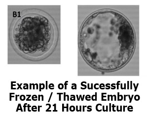 Frozen Thawed Embryo After 21 Hours Culture